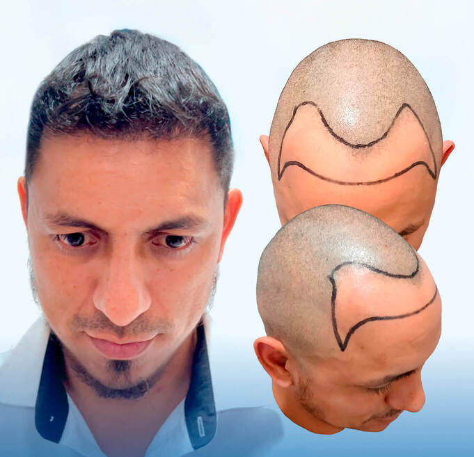 IMAGEN 1 ESCRITORIO